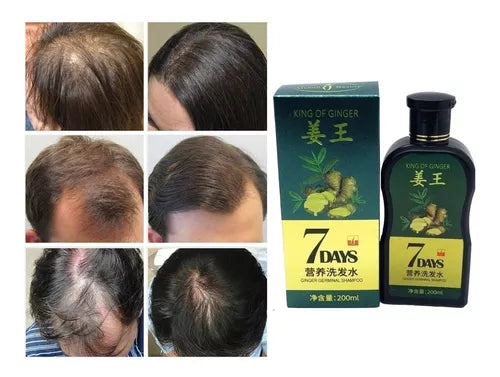 Shampoo de jengibre 7Days